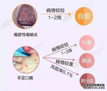 带状疱疹注射带状疱疹可能是一种治疗方法。