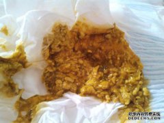 宝宝一个星期出生，大便，有时是水