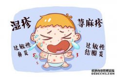 什么是新的互惠餐，以解释婴儿如何对奶粉过敏