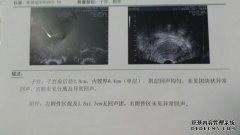 囊性病变是什么意思？